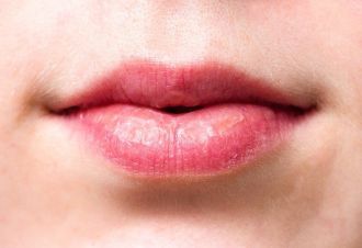 Wrinkles Above the Lips: The Best Treatments & Prevention